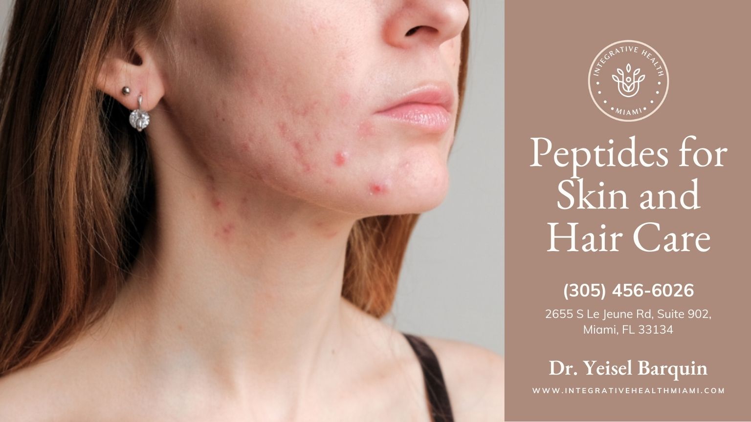 A woman's face displaying acne, with noticeable blemishes on her cheeks and neck, emphasizing her sensitive skin.
